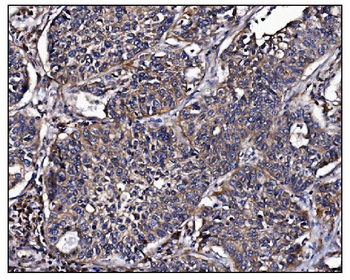 POGLUT1 Antibody