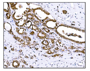 Prolyl Endopeptidase/PREP Antibody