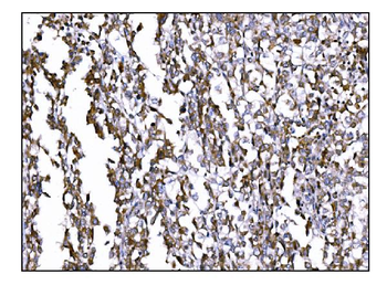 Prolyl Endopeptidase/PREP Antibody