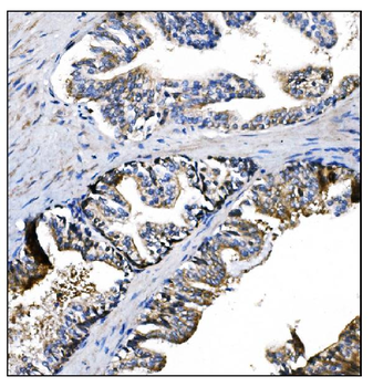 Prolyl Endopeptidase/PREP Antibody