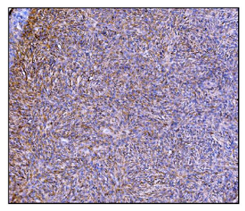 Prolyl Endopeptidase/PREP Antibody