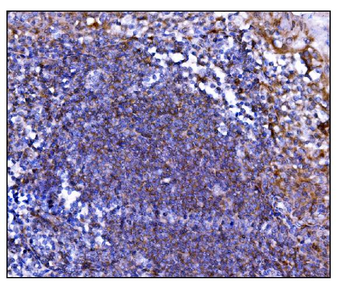 Prolyl Endopeptidase/PREP Antibody