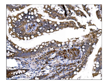 Prolyl Endopeptidase/PREP Antibody