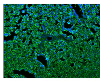 CD45/PTPRC Rabbit Polyclonal Antibody