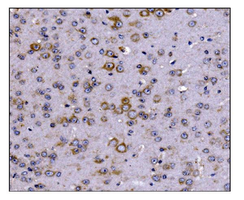SCN1B Rabbit Polyclonal Antibody