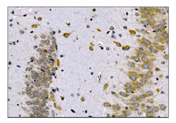 SCN1B Rabbit Polyclonal Antibody