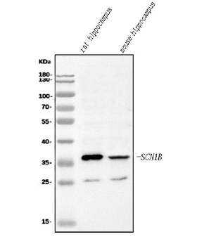 SCN1B Rabbit Polyclonal Antibody