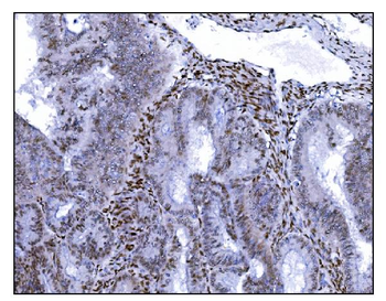 Serum Response Factor/SRF Antibody
