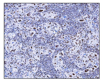 Serum Response Factor/SRF Antibody
