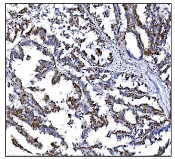Serum Response Factor/SRF Antibody