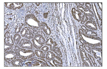 Serum Response Factor/SRF Antibody