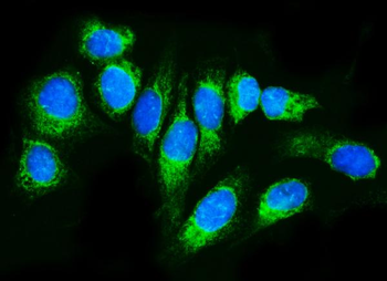 TRAP alpha/TRAPA/SSR1 Antibody