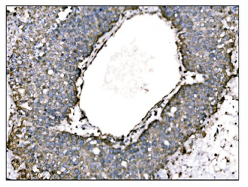 TRAP alpha/TRAPA/SSR1 Antibody