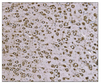 TRAP alpha/TRAPA/SSR1 Antibody