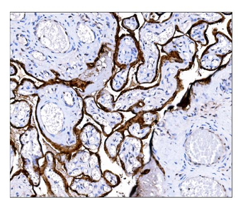 Steroid sulfatase/STS Rabbit Polyclonal Antibody
