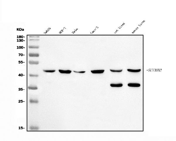 KMT1B/SUV39H2 Antibody