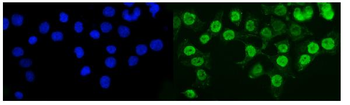 KMT1B/SUV39H2 Antibody