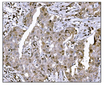 KMT1B/SUV39H2 Antibody