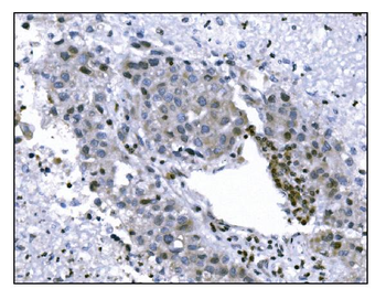 KMT1B/SUV39H2 Antibody