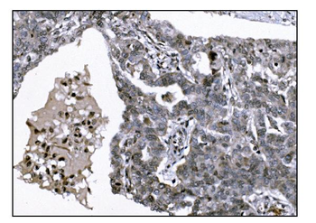 KMT1B/SUV39H2 Antibody