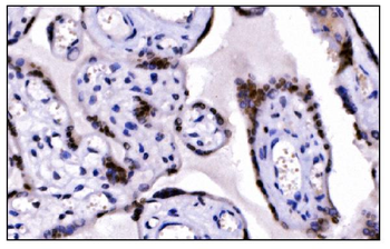 KMT1B/SUV39H2 Antibody