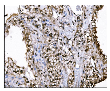 KMT1B/SUV39H2 Antibody