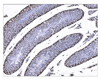 KMT1B/SUV39H2 Antibody