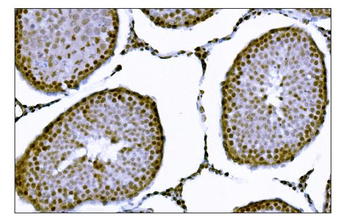KMT1B/SUV39H2 Antibody