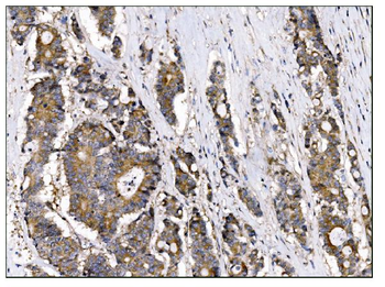 AS160/TBC1D4 Antibody