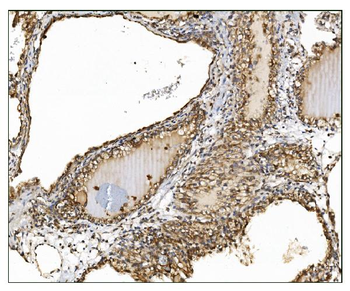 AS160/TBC1D4 Antibody