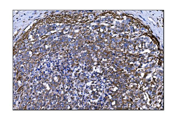 TLR8 Rabbit Polyclonal Antibody
