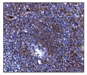 TLR8 Rabbit Polyclonal Antibody