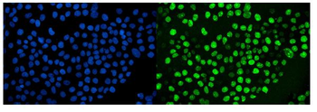 Ki67 Antibody (monoclonal, 5E12)