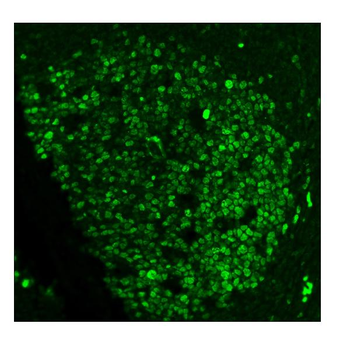 Ki67 Antibody (monoclonal, 5E12)