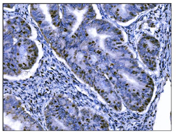 Ki67 Antibody (monoclonal, 5E12)