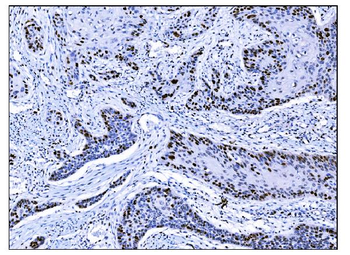 Ki67 Antibody (monoclonal, 5E12)