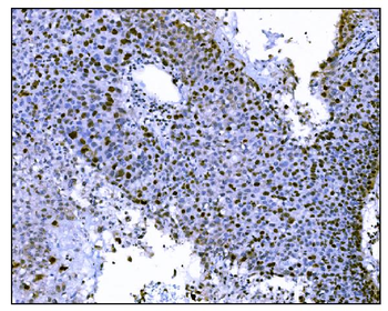 Ki67 Antibody (monoclonal, 5E12)