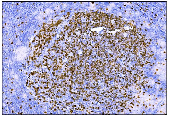 Ki67 Antibody (monoclonal, 5E12)