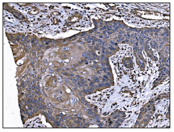 TGFBR2 Antibody (monoclonal, 2F11)