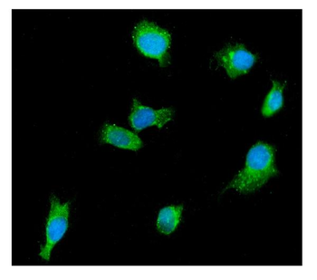 DDX6 Mouse Monoclonal Antibody