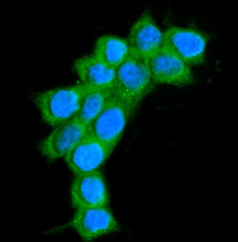 AlaRS/AARS1 Rabbit Polyclonal Antibody
