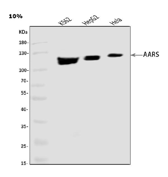 AlaRS/AARS1 Rabbit Polyclonal Antibody