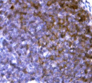 Cd19 Rabbit Polyclonal Antibody