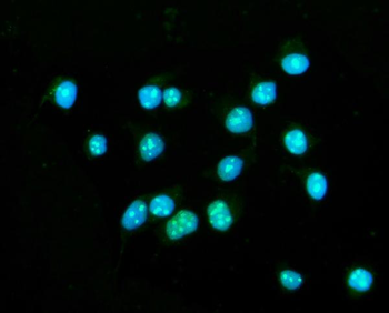 CENPB Rabbit Polyclonal Antibody