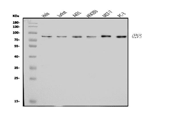 CENPB Rabbit Polyclonal Antibody