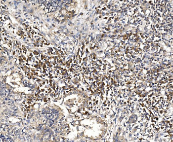DAP1/DAP Antibody