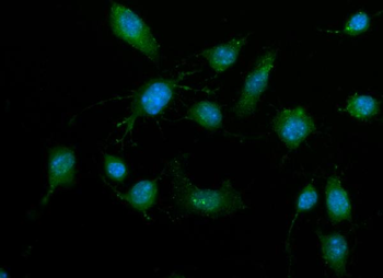 ZIP Kinase/Dapk3 Rabbit Polyclonal Antibody