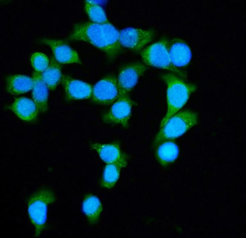 DIAPH1 Antibody