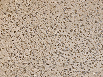 EIF5 Antibody
