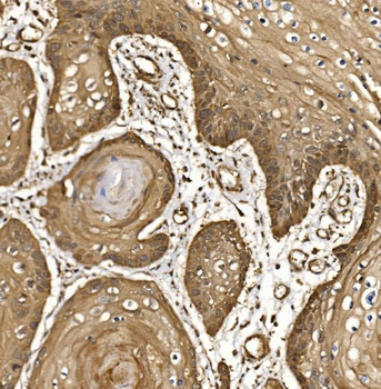 EIF5 Antibody